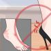 Mi a teendő, ha a cipője dörzsöli a sarka hátsó részét: tippek
