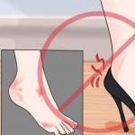 Mi a teendő, ha a cipője dörzsöli a sarka hátsó részét: tippek