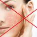 Regler för att använda en ansiktsmask gjord av lera Vilken lera är bättre att göra en ansiktsmask